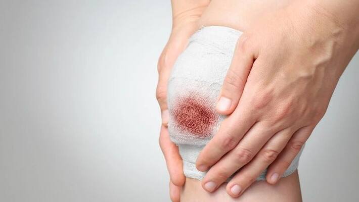 zinc deficiency may cause lag in healing wounds zinc deficiency may cause lag in healing wounds