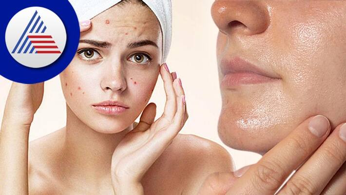 Skin Signs That Shows You Are Using Wrong Products Skin Signs That Shows You Are Using Wrong Products