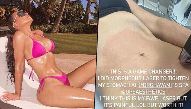 Kim Kardashian Shows Photo of Painful Stomach Laser Treatment