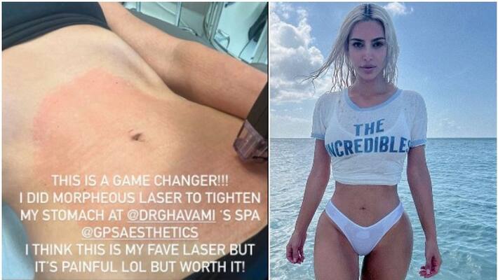 Kim Kardashian shares a photo of Stomach Tightening Treatment sgk Kim Kardashian shares a photo of Stomach Tightening Treatment sgk