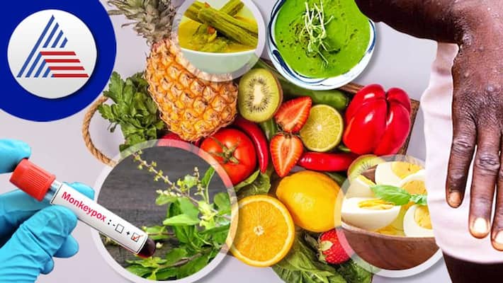 Foods For Monkeypox Recovery And Strong Immunity Vin Foods For Monkeypox Recovery And Strong Immunity Vin