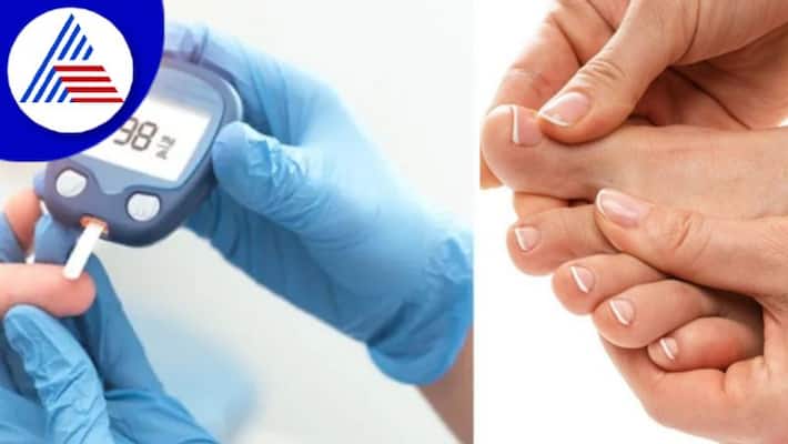 Hidden Signs Of High Blood Sugar Level That You Might See on Your Feet Vin Hidden Signs Of High Blood Sugar Level That You Might See on Your Feet Vin