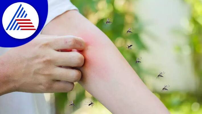 Do Mosquitoes Bite You More Than Others Vin Do Mosquitoes Bite You More Than Others Vin
