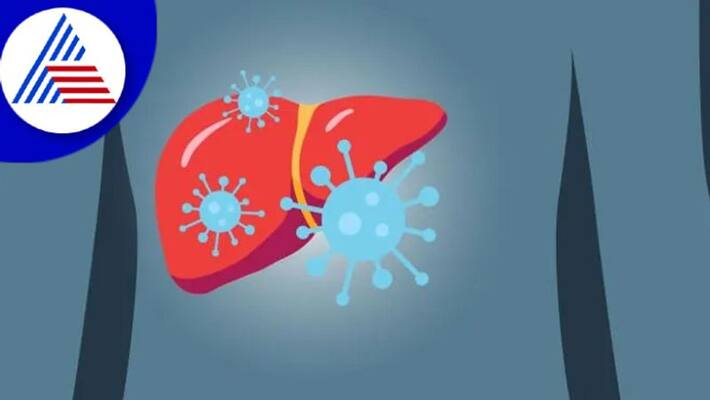Hepatitis Take Special Care Of These Things For Prevention Vin Hepatitis Take Special Care Of These Things For Prevention Vin