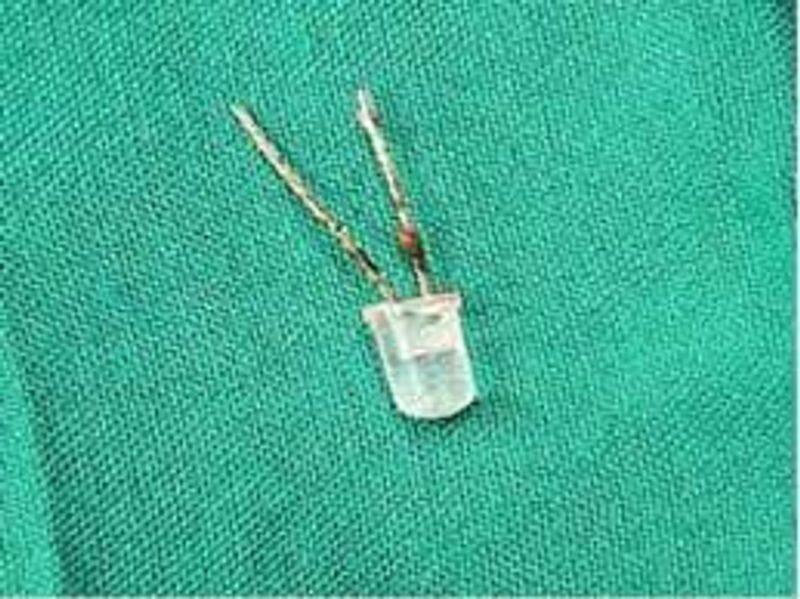 Child swallowed LED bulb - doctors surgically remove it from baby's s