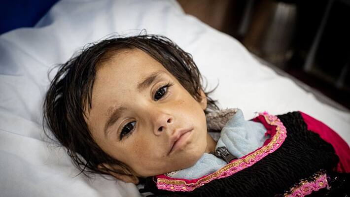 Afghan kids dies from starvation a year on from Taliban takeover Afghan kids dies from starvation a year on from Taliban takeover