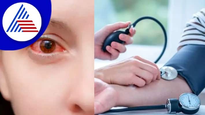 This Symptom Of Silent Killer High BP Is Seen In The Eyes Vin This Symptom Of Silent Killer High BP Is Seen In The Eyes Vin