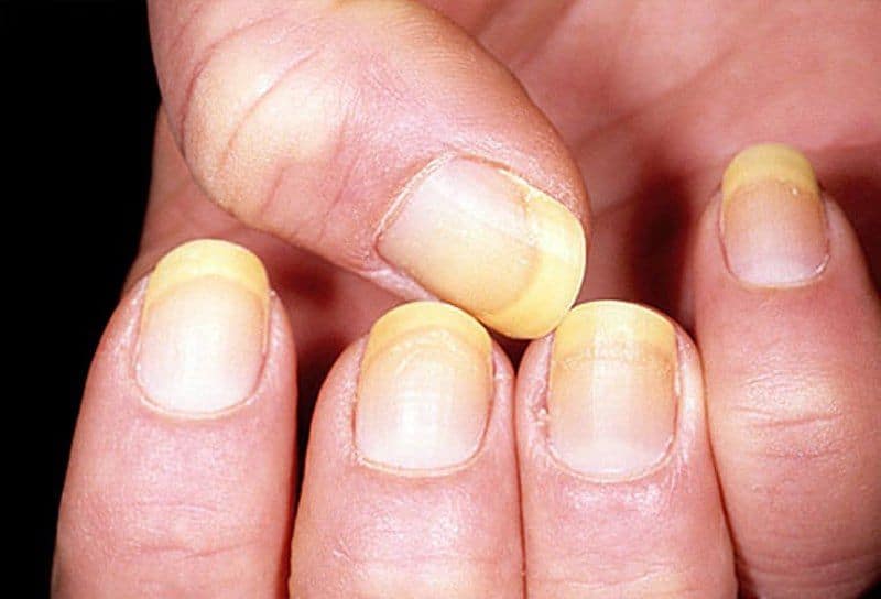nails health tamil