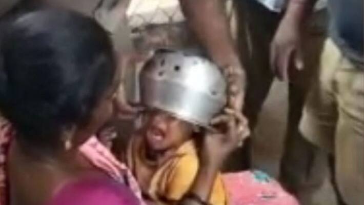 A one and a half year old child's head stuck in the vessel A one and a half year old child's head stuck in the vessel