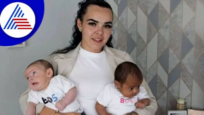 Woman Gives Birth To One In A Million Black And White Twin Vin Woman Gives Birth To One In A Million Black And White Twin Vin