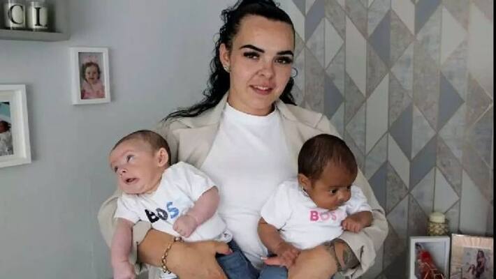 woman gave birth to black and white twins which is very rare woman gave birth to black and white twins which is very rare