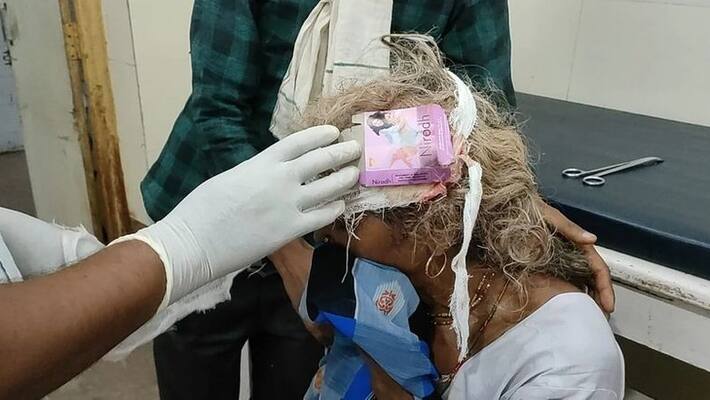 condom pack used to dress womans head injury at health centre in mp condom pack used to dress womans head injury at health centre in mp