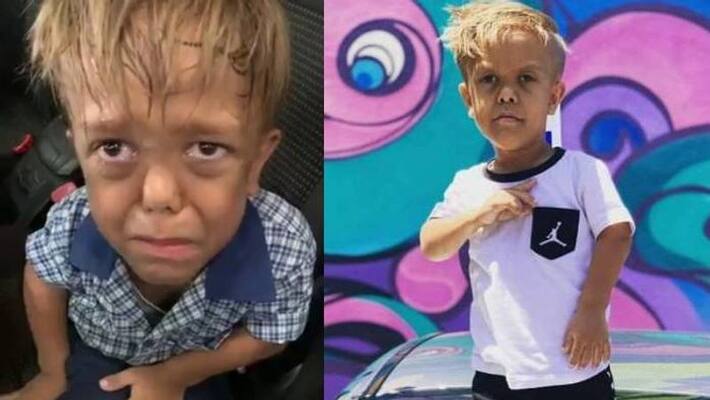 Bullied boy scores role in George Miller's movie Bullied boy scores role in George Miller's movie