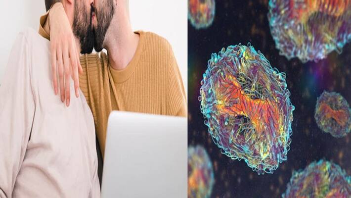 Italian man becomes the first person in world to test positive for monkeypox Covid and HIV at SAME time NTP Italian man becomes the first person in world to test positive for monkeypox Covid and HIV at SAME time NTP