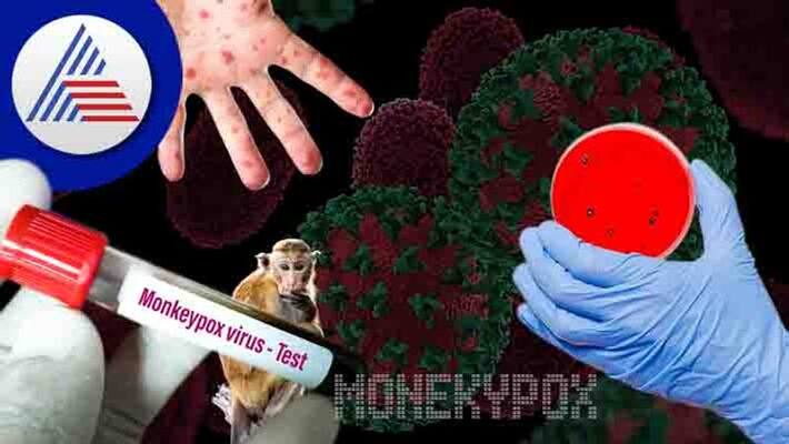 Monkeypox : Many countries are taking strict measures Monkeypox : Many countries are taking strict measures