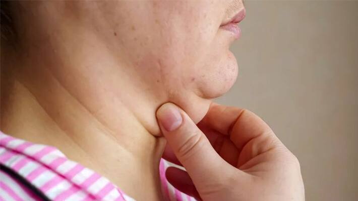 Five effective exercise to reduce double chin dva Five effective exercise to reduce double chin dva