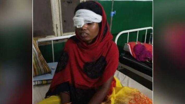 shocking crime Chhattisgarh husband beat up wife then put a finger and removed eye in surguja kpr shocking crime Chhattisgarh husband beat up wife then put a finger and removed eye in surguja kpr