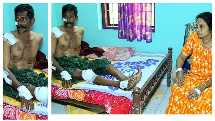 thrissur couple injured in pothole accident thrissur couple injured in pothole accident