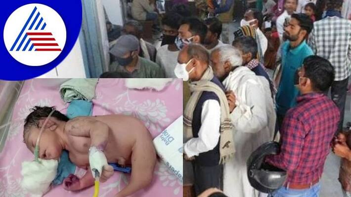 Physical different baby born in Madhya pradesh, infant have Horn Like Structure Instead of Legs akb Physical different baby born in Madhya pradesh, infant have Horn Like Structure Instead of Legs akb