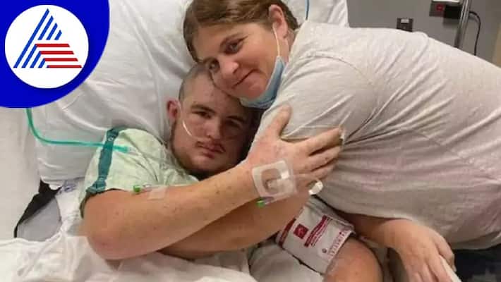 US Man In Hospital After 20,000 Bee Stings, Doctors Remove Dozens He Swallowed Vin US Man In Hospital After 20,000 Bee Stings, Doctors Remove Dozens He Swallowed Vin