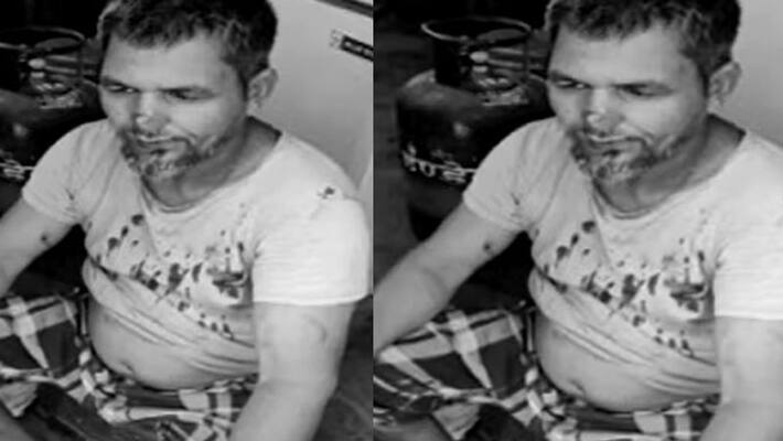 youth cut off the employee nose for not offering biryani at a low price in nose youth cut off the employee nose for not offering biryani at a low price in nose