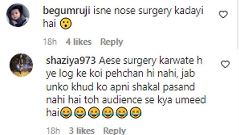 Bigg Boss fame Nikki Tamboli gets trolled because of her outfit and face, people are speculating about her surgery GGA