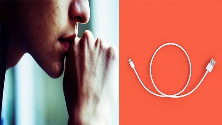 15 year old boy gets usb cable stuck in his penis Doctor removed from surgery NTP 15 year old boy gets usb cable stuck in his penis Doctor removed from surgery NTP