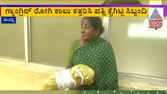 Hospital Staff Hands Over Husbands leg to wife after gangrene operation in Mandya mnj Hospital Staff Hands Over Husbands leg to wife after gangrene operation in Mandya mnj