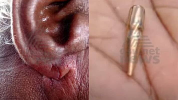 fisherman get shot in fort kochi sea fisherman get shot in fort kochi sea