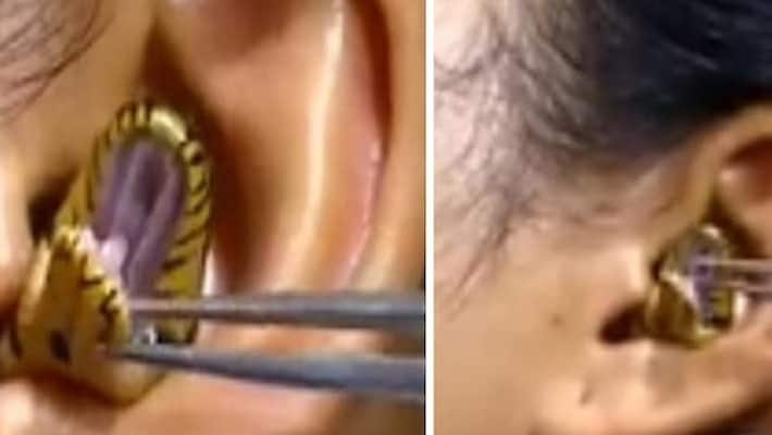 snake gets trapped in womans ear hole doctor tries to pull out with tongs in viral video ash snake gets trapped in womans ear hole doctor tries to pull out with tongs in viral video ash
