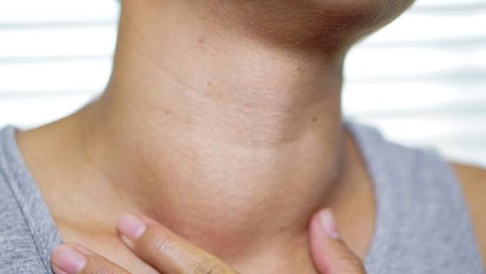 symptoms of hypothyroidism and foods to avoid symptoms of hypothyroidism and foods to avoid