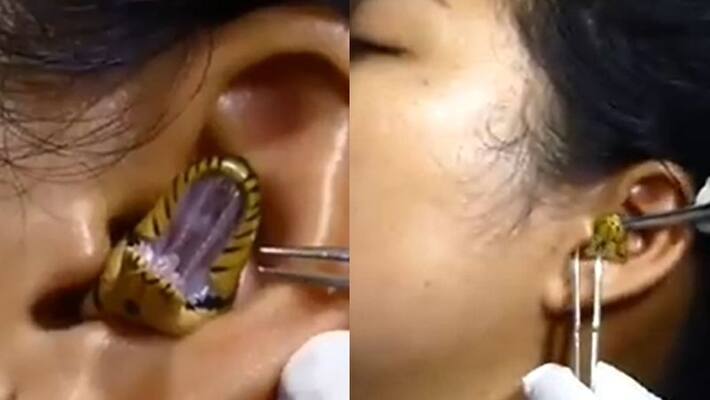 snake went inside womans ear and video goes viral snake went inside womans ear and video goes viral