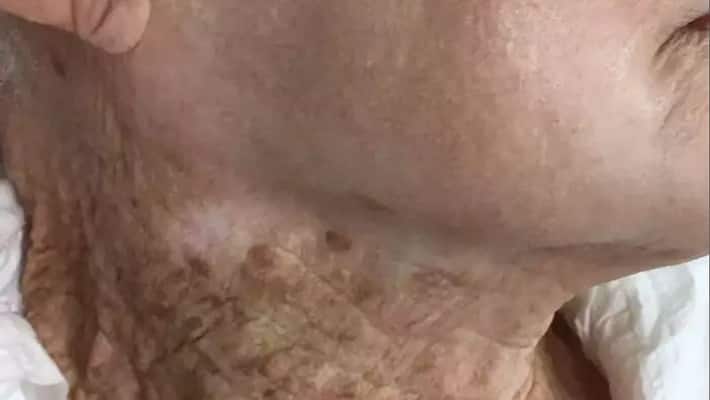 Exposure to sun's uv rays without sunscreen can lead to dire consequences for women internet shocking bsm Exposure to sun's uv rays without sunscreen can lead to dire consequences for women internet shocking bsm