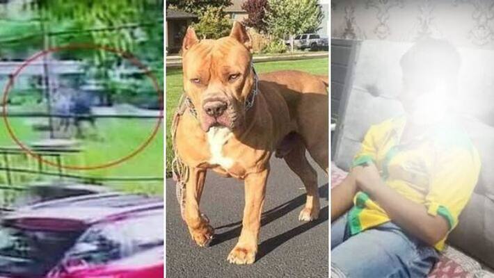 Viral video 11 year old attacked by pit bull 200 stitches on his face Viral video 11 year old attacked by pit bull 200 stitches on his face