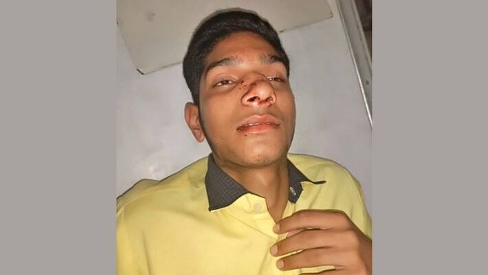 sikar news boy beaten by hostel operator and fellow students for not giving money for party asc sikar news boy beaten by hostel operator and fellow students for not giving money for party asc
