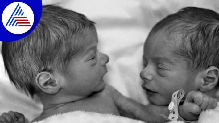 19 Year Old Woman Delivers Twins With Different Biological Dads Vin 19 Year Old Woman Delivers Twins With Different Biological Dads Vin