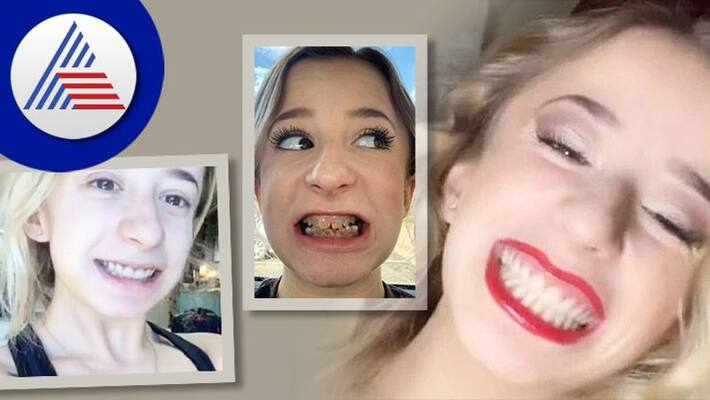 Woman Born With Transparent Teeth Gets life changing dental surgery Vin Woman Born With Transparent Teeth Gets life changing dental surgery Vin