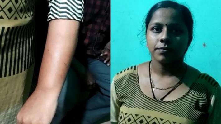 student injured after dog bite student injured after dog bite