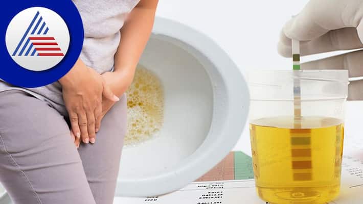 Urine smells due to these diseases Urine smells due to these diseases