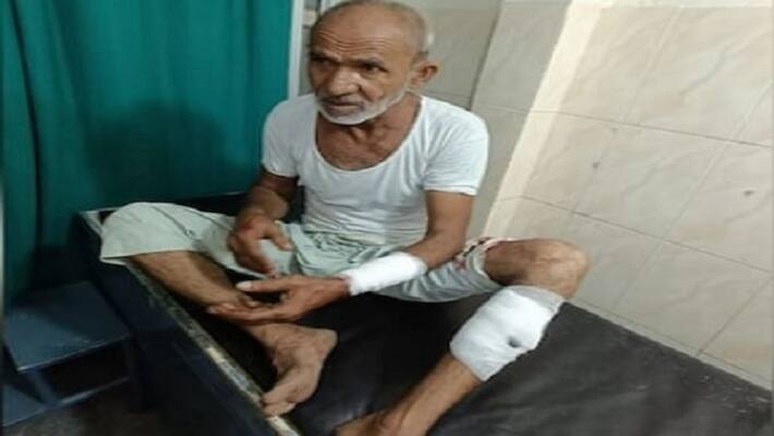 a stray dog attacked a 60 year oli man who went on a morning walk in noida got so mant stitches during treatment a stray dog attacked a 60 year oli man who went on a morning walk in noida got so mant stitches during treatment