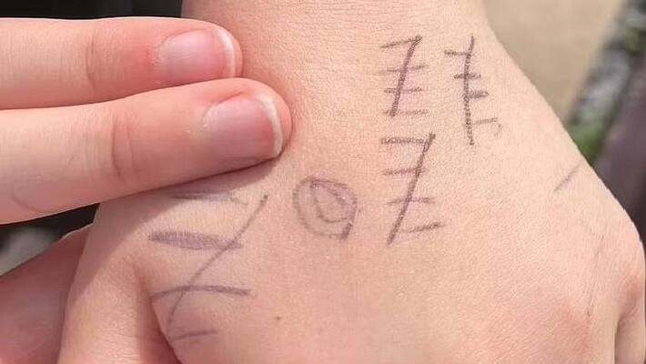pen marks on sons hand shows number of time he bullied from school pen marks on sons hand shows number of time he bullied from school
