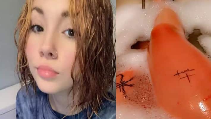14 year old girl revealed that she has been diagnosed with a rare water allergy NTP 14 year old girl revealed that she has been diagnosed with a rare water allergy NTP