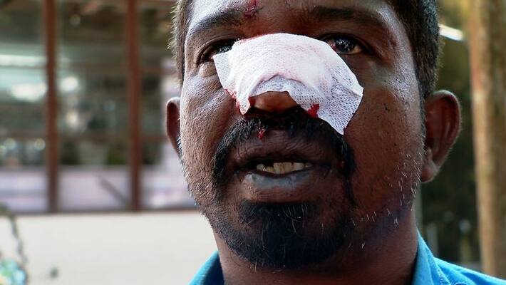 harthal in kerala: pfi organised Harthal becomes violent in Kerala harthal in kerala: pfi organised Harthal becomes violent in Kerala