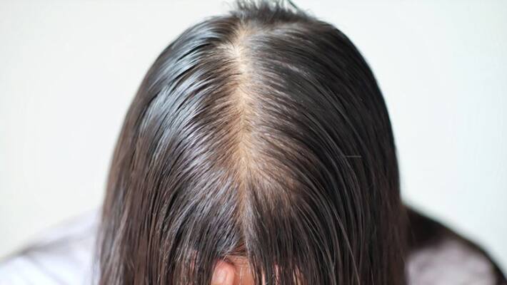effective solutions to treat hair thinning effective solutions to treat hair thinning