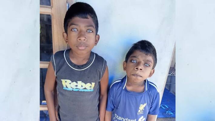 alappuzha brothers need treatment help for Mucopolisacaridosis alappuzha brothers need treatment help for Mucopolisacaridosis