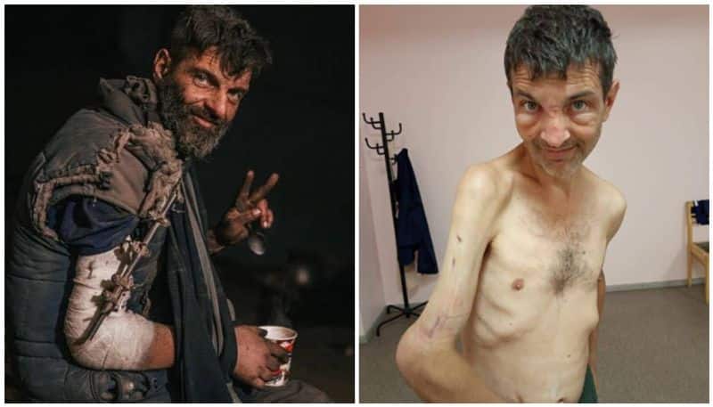 Ukraine soldier before and after Russian captivity 