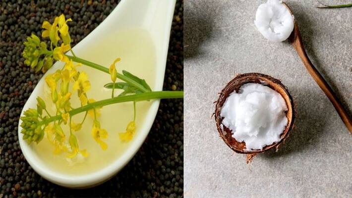 Mustard or coconut oil which oil is healthy for hair dva Mustard or coconut oil which oil is healthy for hair dva