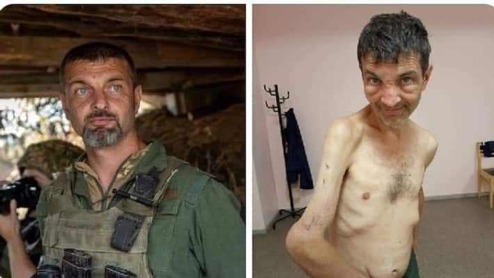 Ukraine shows horrific before-after images of soldier released by Russians after 4 months of torture apa Ukraine shows horrific before-after images of soldier released by Russians after 4 months of torture apa