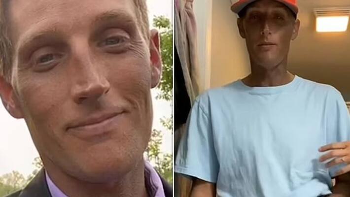 mans skin turned dark after having antidepressant drug mans skin turned dark after having antidepressant drug