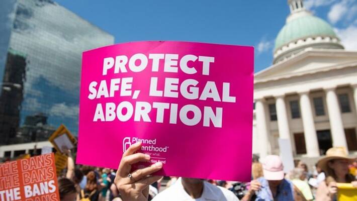Abortion Rules in America and different countries in the world kpg Abortion Rules in America and different countries in the world kpg